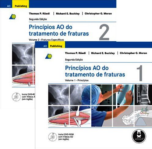 Princípios AO do Tratamento de Fraturas